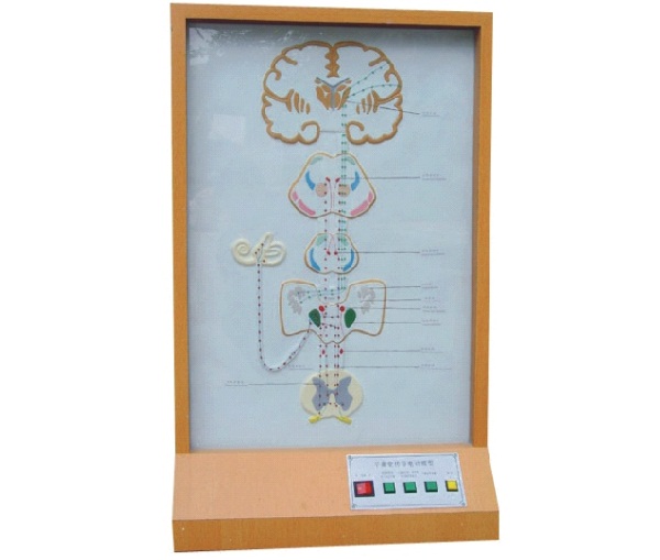 平衡覺(jué)傳導電動(dòng)模型.jpg